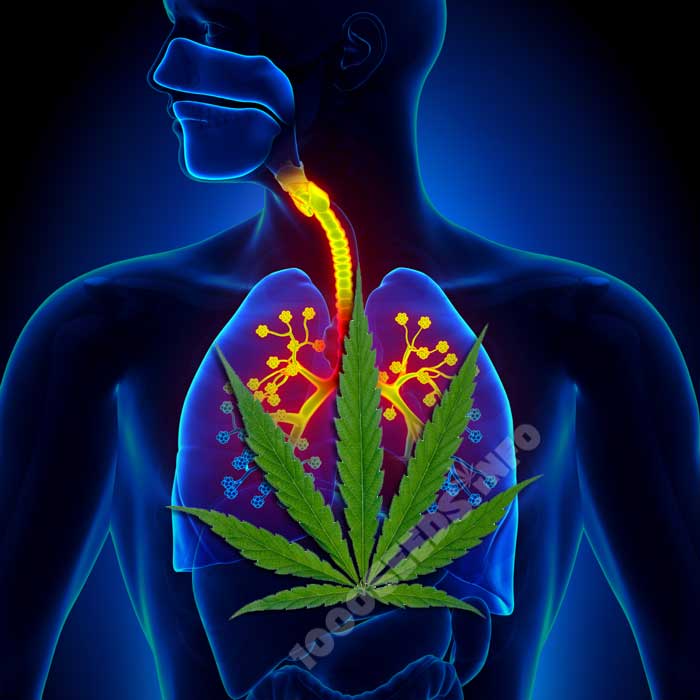 Asthma-Cannabis, Cannabis in der Medizin, Cannabis und Atemwegserkrankungen