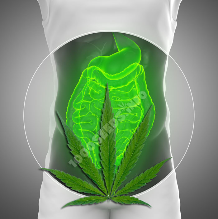 morbus-crohn-und-Cannabis, Cannabis bei Morbus Crohn, Cannabis in der Medizin