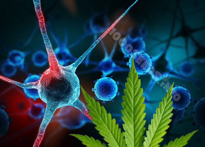 Neuropatía y cannabis, cannabis para enfermedades neuropáticas